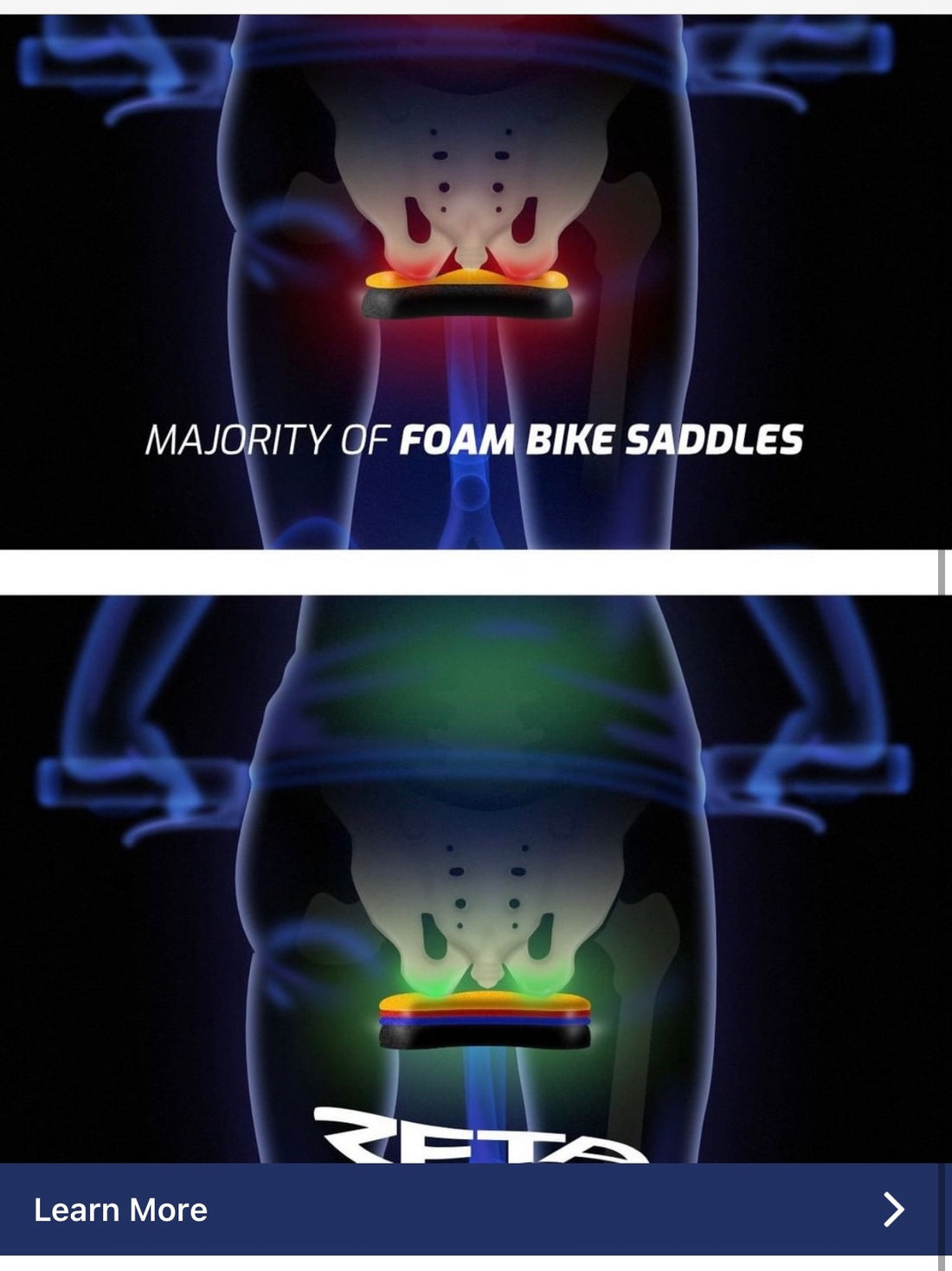 Bike Saddle Discomfort?  Zeta Saddles has cracked the code on comfort!